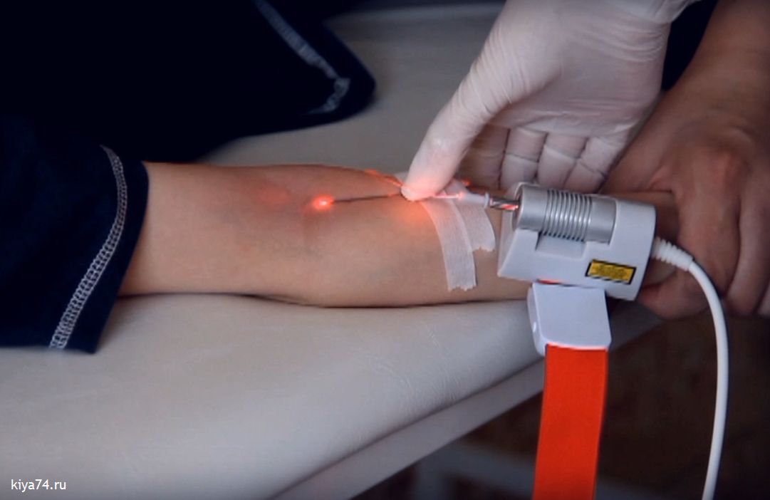 лазерное облучение крови детям